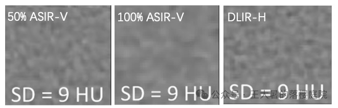 #105 CT重建的3D深度学习技术——迭代算法详解 #105 CT重建的3D深度学习技术——迭代算法详解