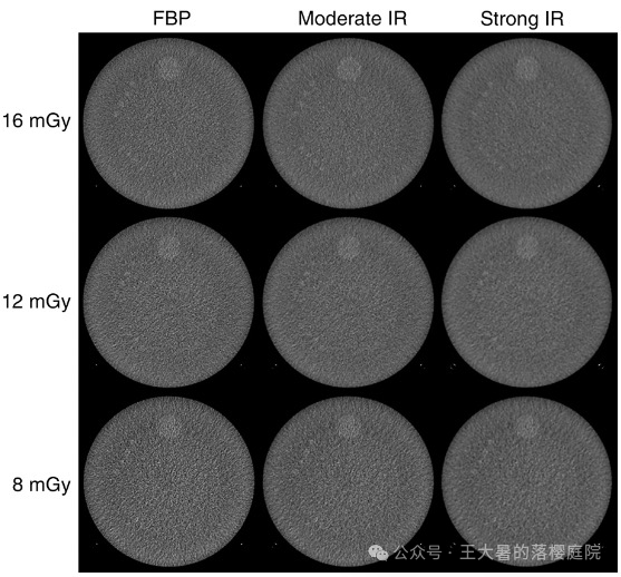 #108 CT重建的3D深度学习技术——深度学习图像重建算法分类2 #108 CT重建的3D深度学习技术——深度学习图像重建算法分类2