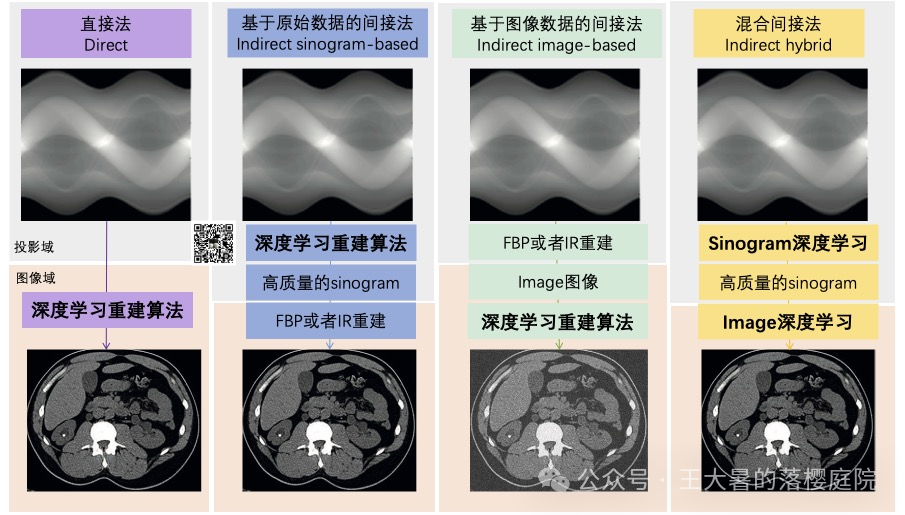 #108 CT重建的3D深度学习技术——深度学习图像重建算法分类2 #108 CT重建的3D深度学习技术——深度学习图像重建算法分类2