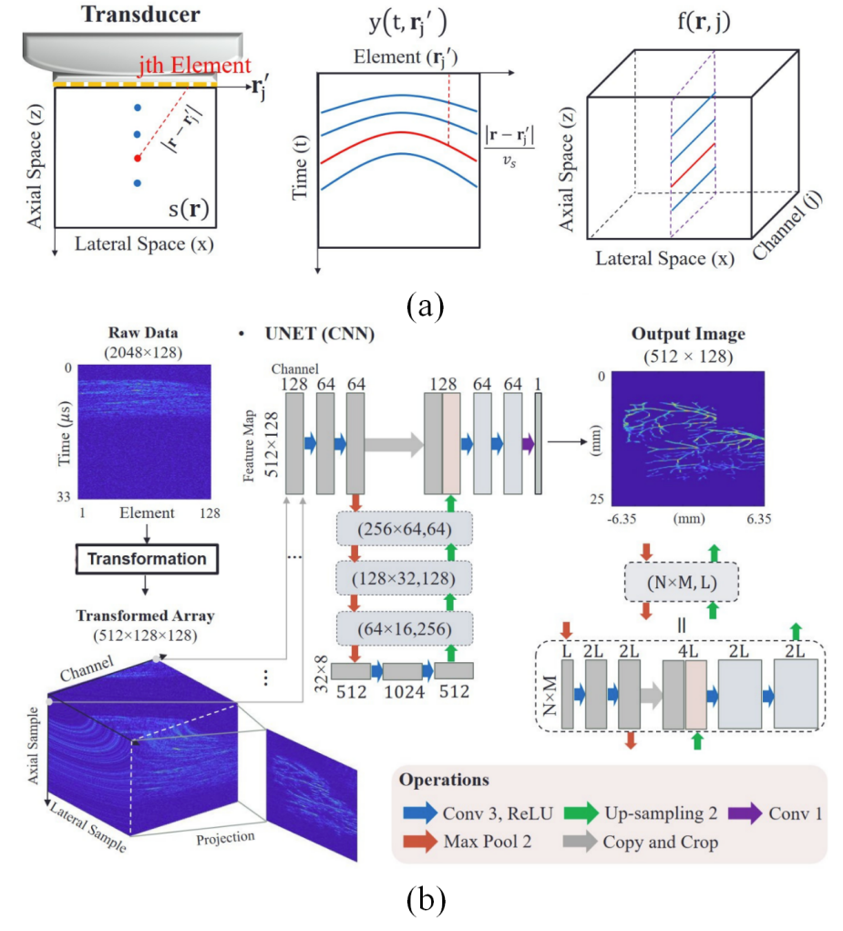综述:深度学习驱动下的光声成像技术 综述:深度学习驱动下的光声成像技术