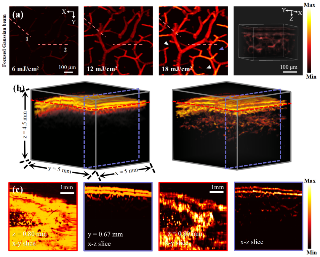 综述:深度学习驱动下的光声成像技术 综述:深度学习驱动下的光声成像技术